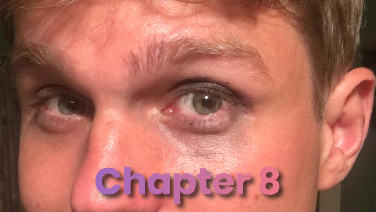 Close-up photo of a man's eyes with smudged eyeliner.